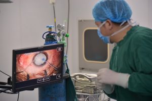 savoir et comprendre la chirurgie de la cataracte